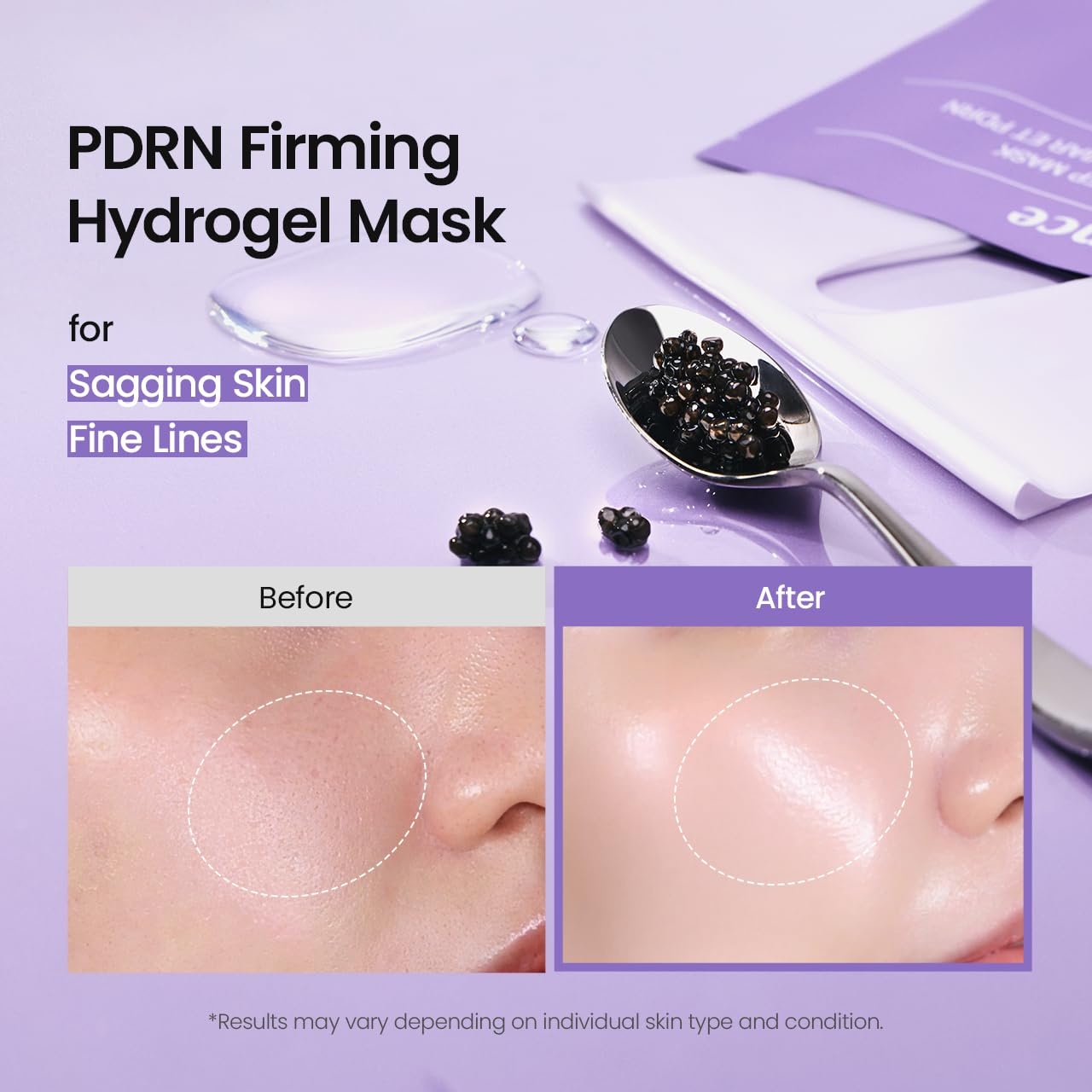 image:imageBIODANCE BioCollagen Real Deep Mask Hydrating Overnight Hydrogel Face Mask Pore Minimizing Elasticity Plumping Travel Essentials amp Self Care Gifts for Women Korean Skin Care 119oz34g x 4eaPDRN