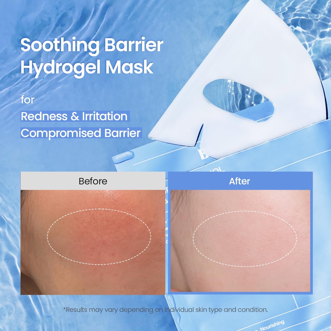 image:imageBIODANCE BioCollagen Real Deep Mask Hydrating Overnight Hydrogel Face Mask Pore Minimizing Elasticity Plumping Travel Essentials amp Self Care Gifts for Women Korean Skin Care 119oz34g x 4eaCeranol