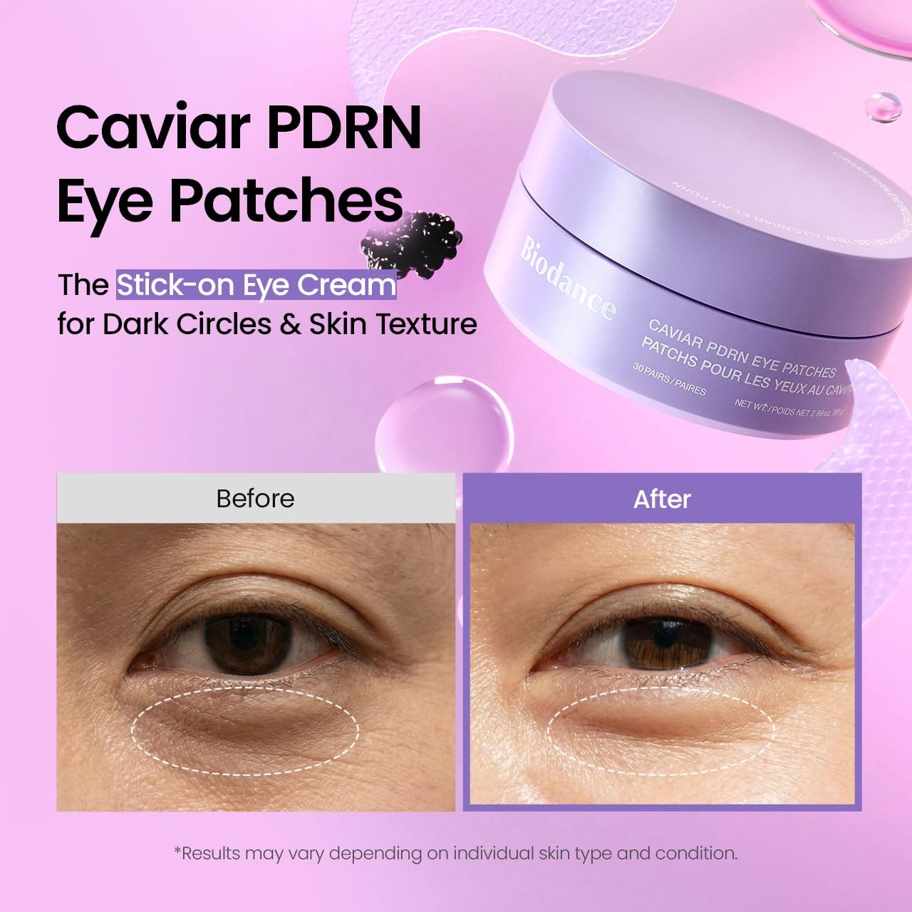 image:imageBIODANCE Hydrogel Eye Patches for Under Eye Vita Niacinamide 60 Count Dull Spot Patches for Face amp Uneven Skin Tone Travel Essentials Self Care Gifts for Women Korean Skin CareCaviar PDRN