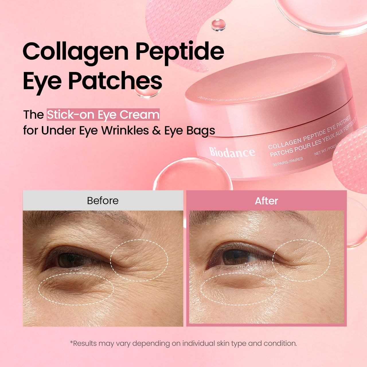 image:imageBIODANCE Hydrogel Eye Patches for Under Eye Vita Niacinamide 60 Count Dull Spot Patches for Face amp Uneven Skin Tone Travel Essentials Self Care Gifts for Women Korean Skin CareCollagen