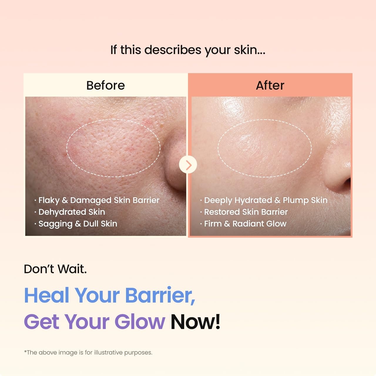 image:imageBIODANCE Barrier Rescue Duo Caviar PDRN amp Ceramide Panthenol Real Deep Overnight Gel Mask for Hydrating Plumping for Glass Skin Korean Skin Care Skin Care Set